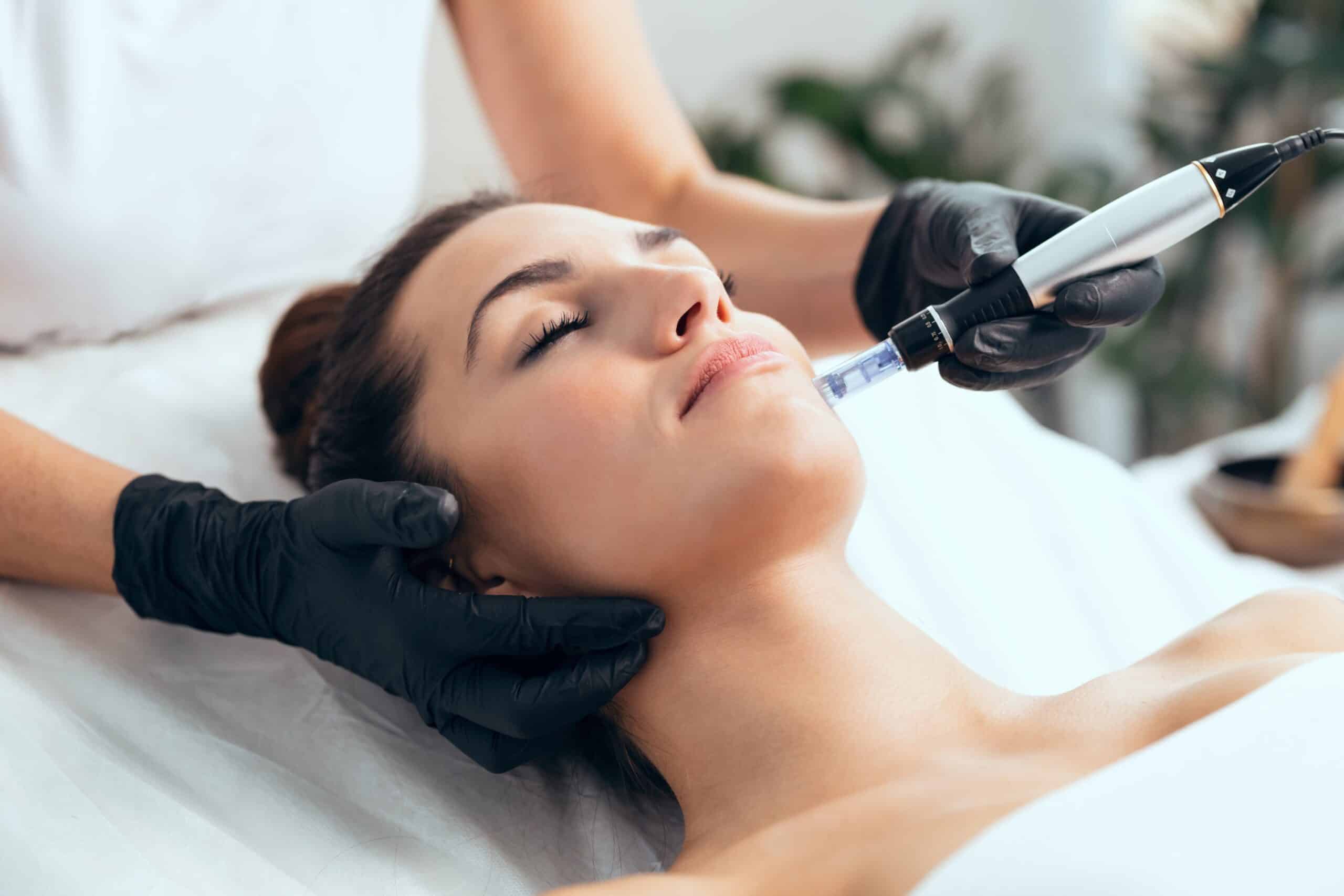 microneedling-Behandlung-mit-Dermapen